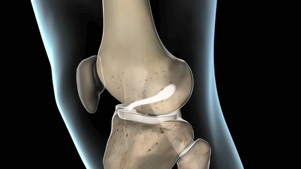 Anterior Cruciate Ligament Knee Joint Render — Stock Photo, Image