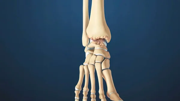 Рендер Ankle Joint Anatomy Остеоартрит Лодыжка Длинные Большеберцовые Малоберцовые Кости — стоковое фото