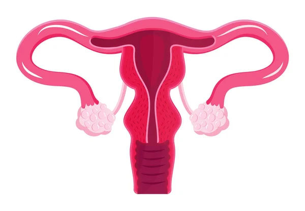 Uterus 아이콘 벡터. 내부 여성 장기. 세계 폐경기, 자궁 내막 증의예. 부인 과 의사가 의료 블로그에 서명하다. — 스톡 벡터