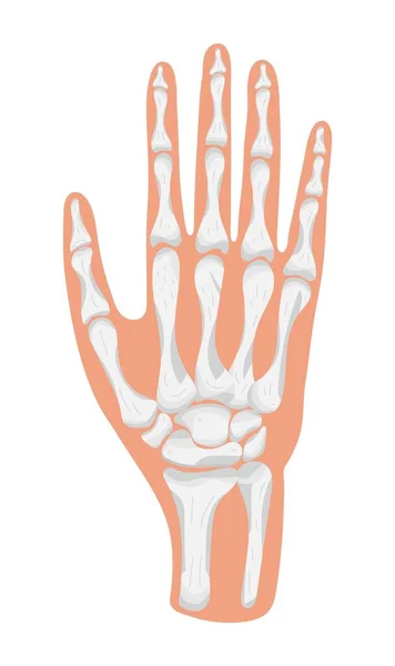 Braço Ícone Mão Radiografia Vetor Conceito Raio Falanges Mão Trauma — Vetor de Stock