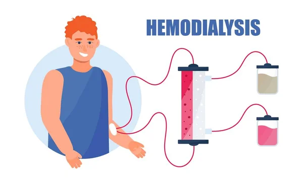 Hemodialysis Concept Vector Method Extrarenal Blood Purification Acute Chronic Renal — Stockvektor