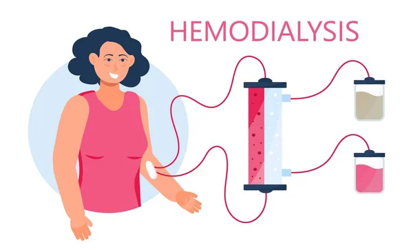 Hemodialysis Concept Vector Method Extrarenal Blood Purification Acute Chronic Renal — Stock vektor