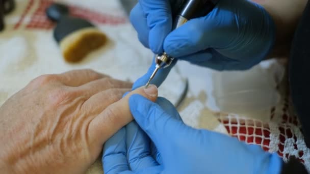 Профессиональный косметолог при лечении онихомикоза и реконструкции ногтей для клиента, лечение здоровья — стоковое видео