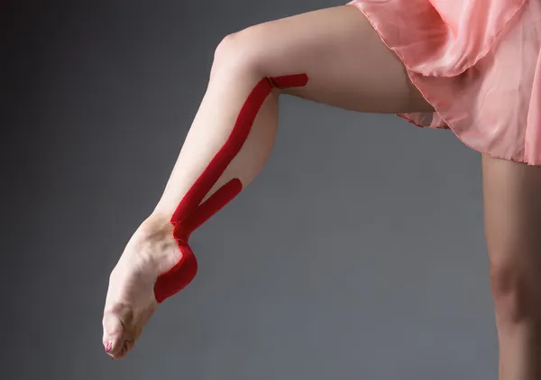 yaralı çemberleme buzağı