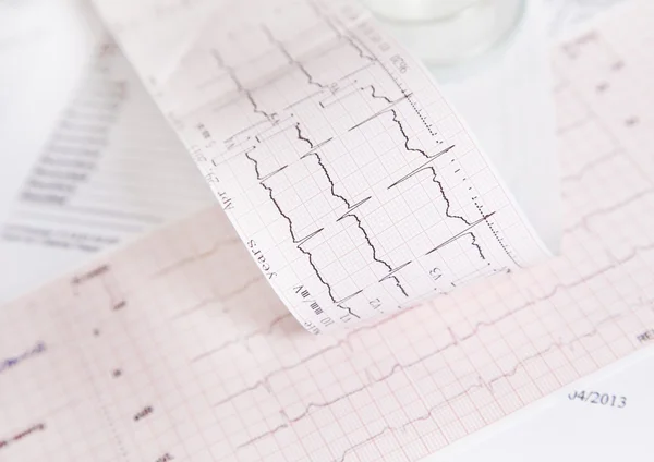 Ekg Herzfrequenzkontrolle — Stockfoto