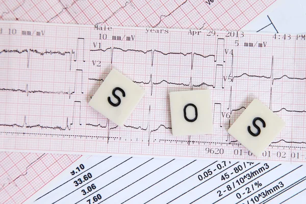 Electrocardiograma con mensaje de advertencia — Foto de Stock