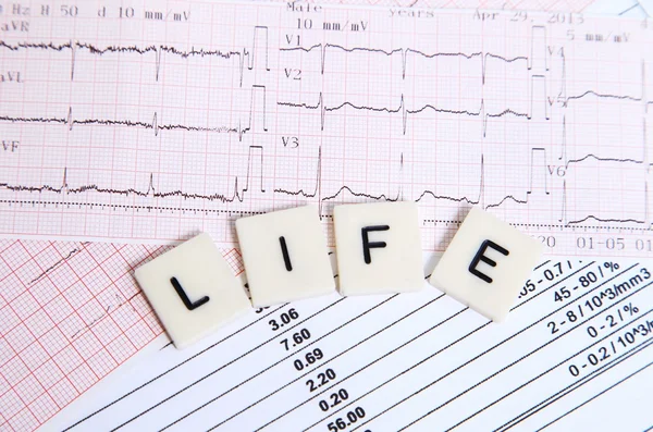 EKG para uma vida saudável — Fotografia de Stock