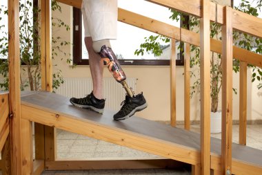 Male prosthesis wearer training to climb a slope clipart