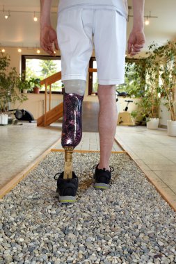 Male prosthesis wearer training to walk clipart