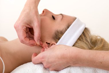 Akupunktur iğnesi kulak uygulayarak homeopath.