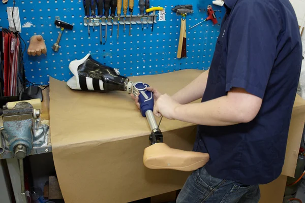Um técnico ajusta um pé protético . — Fotografia de Stock