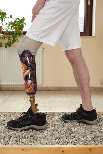 Um usuário de prótese do sexo masculino em uma situação de treinamento . — Fotografia de Stock