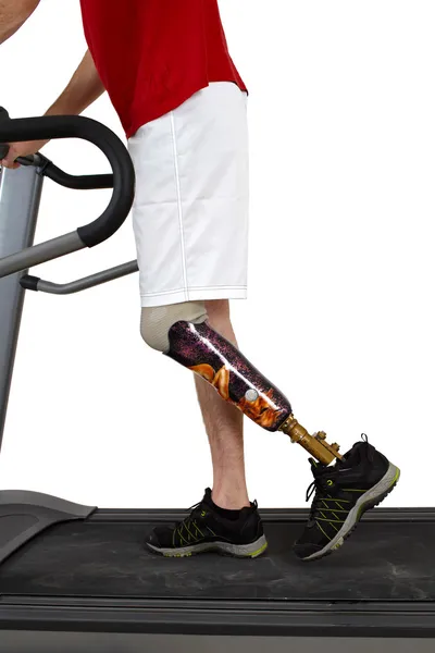 Erkek protez takan geçiren rehabilitasyon — Stok fotoğraf