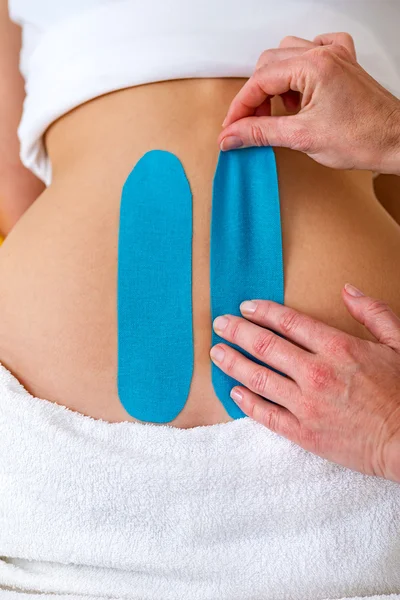 Close-up of an application of kinesiology tapes. — Stock Photo, Image