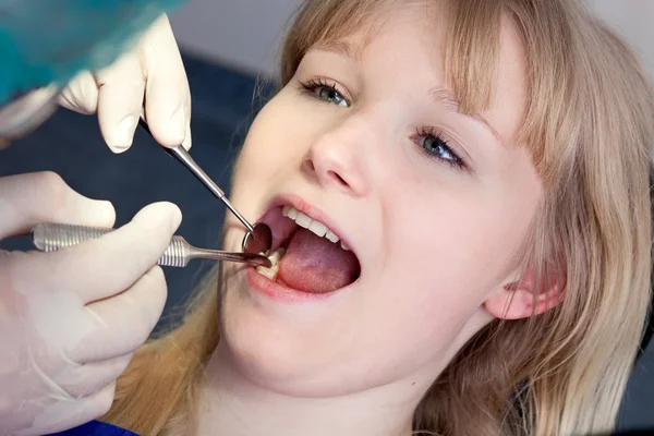 Mulher com molares examinados por um cirurgião-dentista . — Fotografia de Stock