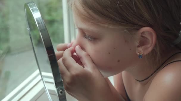 Young Girl Home Front Mirror Squeezes Out Pimples Her Face — Video Stock