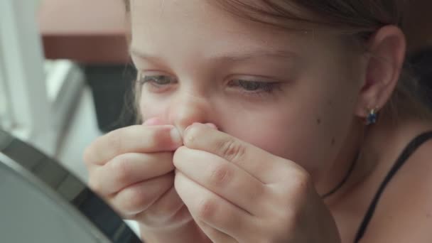 Young Girl Trying Squeeze Out Pimple Her Nose Rash Face — Stock Video