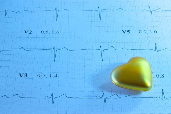 Golden heart on EKG printout — Stock Photo, Image