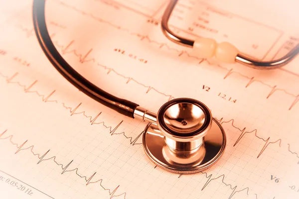 Heartbeat — Stock Photo, Image