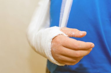 Çocuk, çocuk, eli alçılı çocuk beyaz arka planda. Yakın plan..