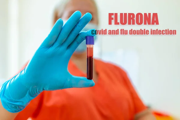 Надпись Flurona Covid Flu Double Infection Coronavirus Covid Flu Ученый — стоковое фото