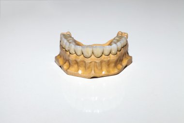 Zirkonyum porselen diş plaka dişçi mağaza