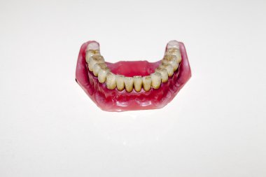 Zirkonyum porselen diş plaka dişçi mağaza