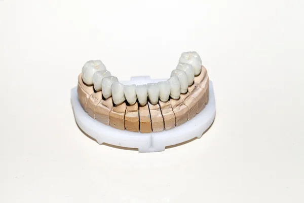 Zirconium Porcelain Tooth plate in Dentist Store — Stock Photo, Image