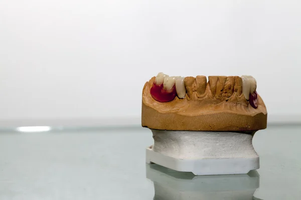 Placa de dientes de porcelana de circonio en la tienda de dentistas — Foto de Stock