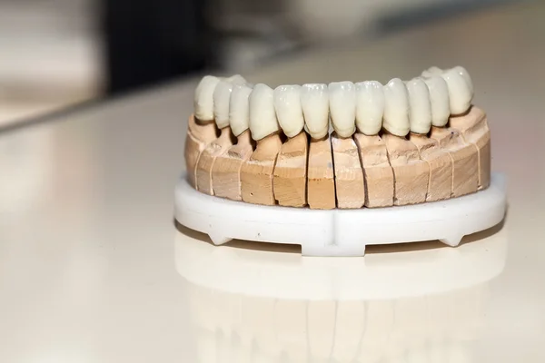 Zirkonyum porselen diş plaka dişçi mağaza