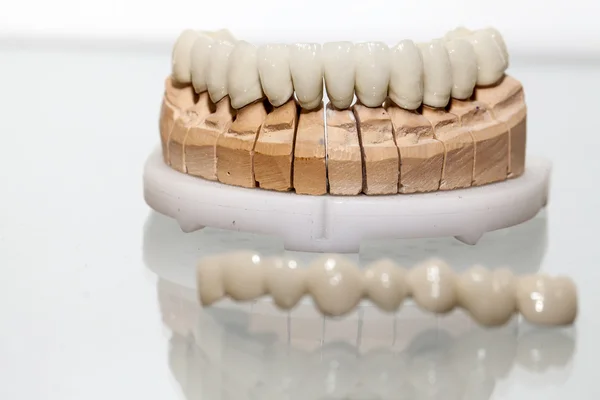 Zirkonyum porselen diş plaka dişçi mağaza