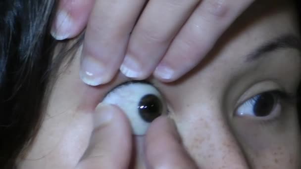 Glazen oog prothese — Stockvideo