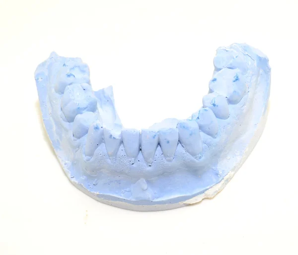 Dental mold — Stock Photo, Image