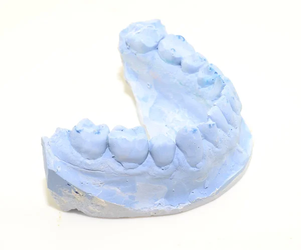 Dental mold — Stock Photo, Image