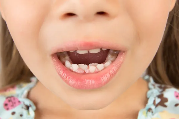 Bocca aperta di una bambina con denti permanenti e di vitello — Foto Stock