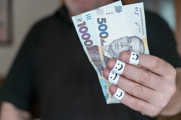 A grown man is holding money in his hand. Some Ukrainian hryvnia banknotes. The first phalanges of his fingers are wrapped in white ribbon. Smiling faces are painted on the bandages.
