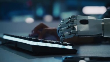 Protez elli kadın bilgisayarda çalışıyor.