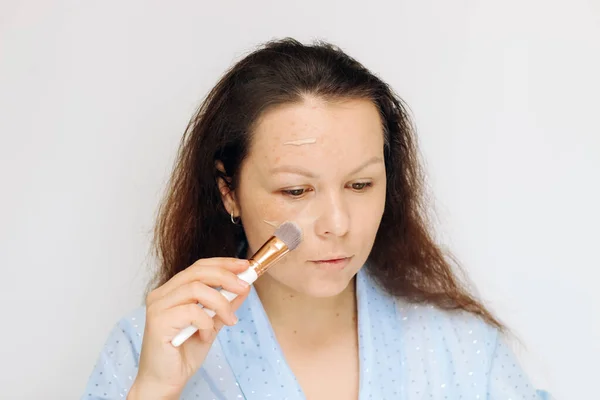 Girl Applies Tonal Corrective Cream Problematic Pigmentation Face — Fotografia de Stock