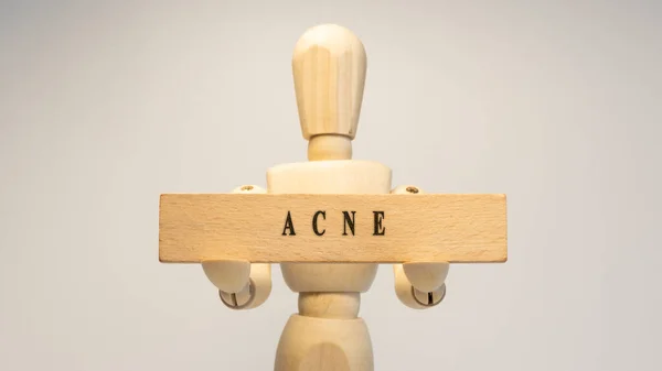 Acne Disease Written Wooden Surface Health Concept — Stock Fotó