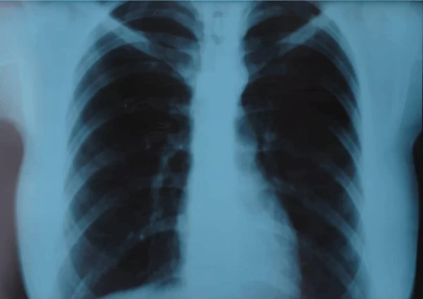 IRM thoracique, radiographie thoracique, radiographie thoracique, fluorographie. Illustration vectorielle réaliste — Image vectorielle