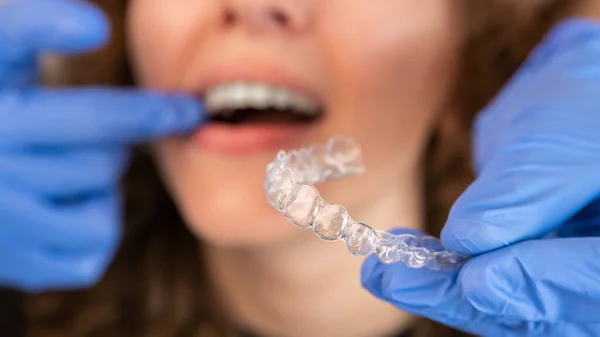 Orthodontist doctor in gloves putting silicone invisible transparent braces on woman\'s teeth in dentist clinic, mouth closeup view. Correcting teeth treatment and cure in dentistry.