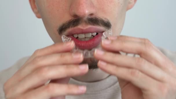Caucasian Young Man Adjusting Placing Invisible Silicone Aligner Dental Correction — Stock Video