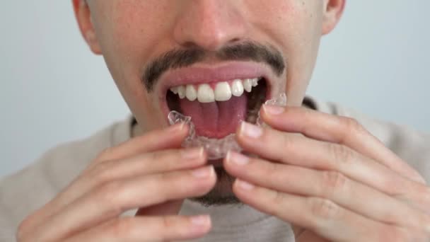 Adult Man Putting Transparent Braces Dental Correction Caucasian Person Holding — Stock Video