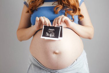 Gri stüdyo arka planında hamile bir kadın ultrason siyah-beyaz taramalı, mutlu anne beklentisi, hamilelik konsepti