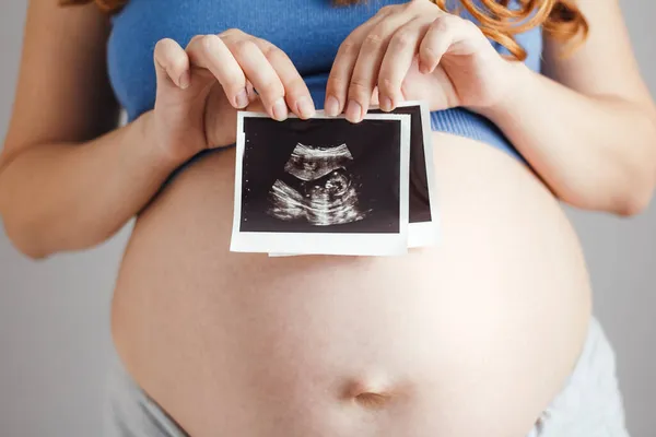 怀孕妇女在灰色工作室背景手握超黑白扫描卡片 快乐妈妈期待 怀孕观念 — 图库照片