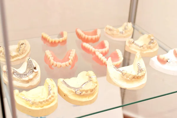 Prótesis dentales —  Fotos de Stock