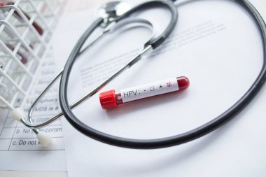 Laboratuvar - kan örneği HPV (insan papilloma virüsü) yetersizlik testi pozitif