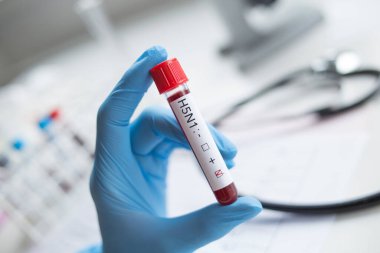 Laboratuvar: Kan örneği H5N1 gribi virüsü ile pozitif.