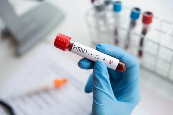 Laboratorio Muestra Sangre Positiva Con Virus Gripe H5N1 —  Fotos de Stock