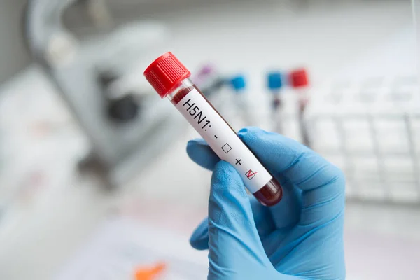 Laboratorio Muestra Sangre Positiva Con Virus Gripe H5N1 — Foto de Stock